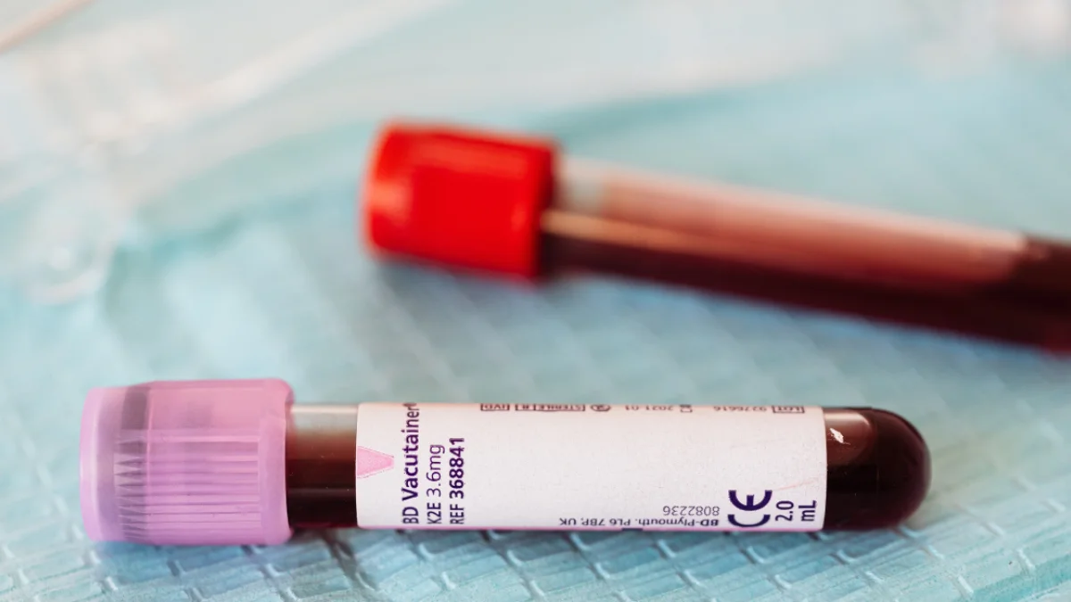 CBC Lab Report Kaise Samjhe