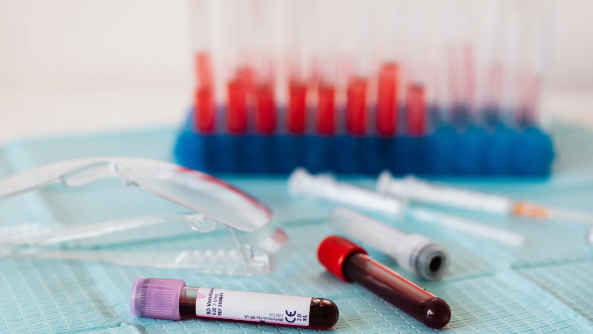 Top 10 Important Blood Tests