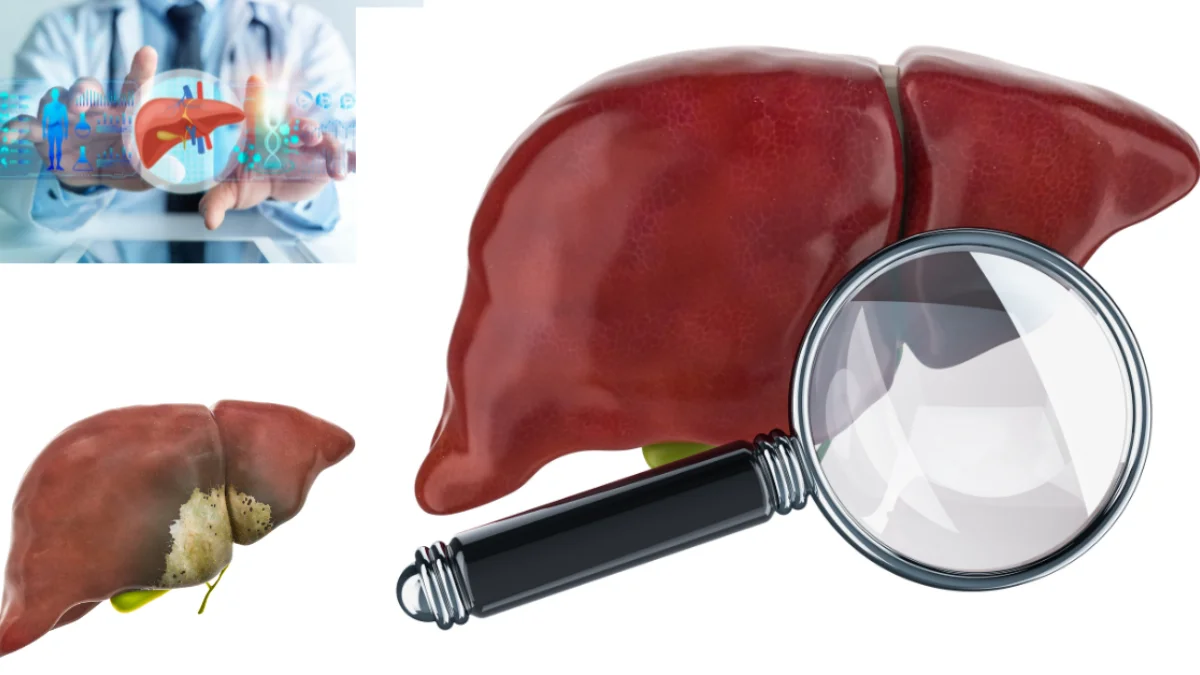 LFT (Liver Function Test) Lab Report